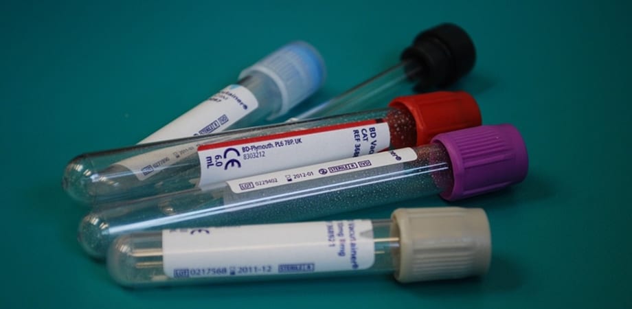 Infecțiile care scad numărul de limfocite! Ce boli se pot ascunde în spatele acestor valori