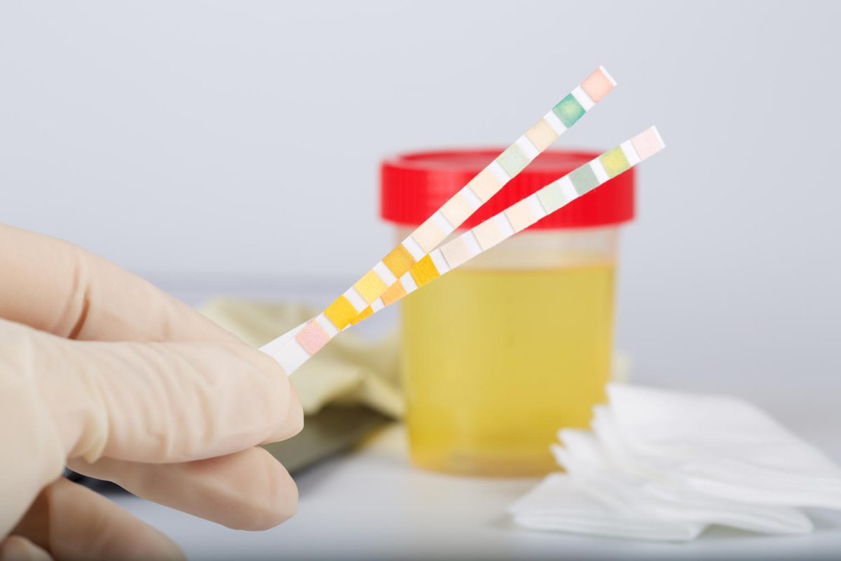 Prezența nitriților pozitivi în urină, semn de infecție? Iată care sunt cauzele!