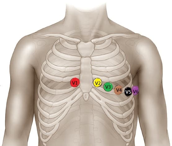 Ghid complet de poziționare electrozi EKG pentru o înregistrare corectă!