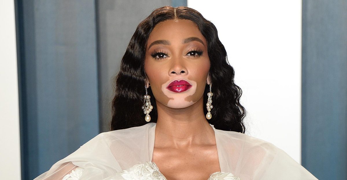 Winnie Harlow postează niște fotografii superbe. Iată cum arată la 31 de ani