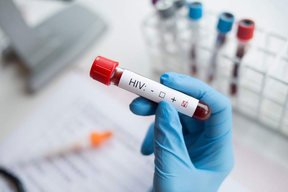 O injecție bianuală poate preveni HIV! UE aprobă medicamentul revoluționar