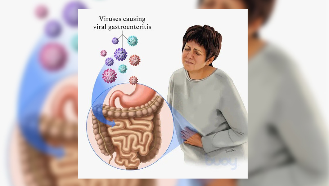 Diareea infecțioasă: când cauza este un parazit sau un virus