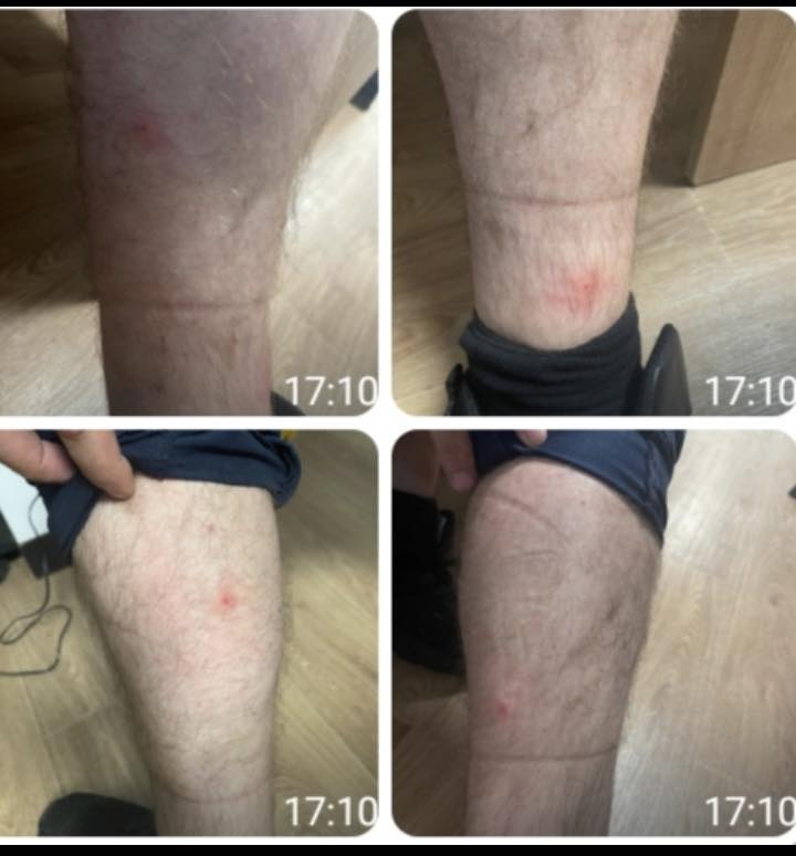Poliţişti muşcaţi de ploşniţe! 10 persoane au ajuns la spital