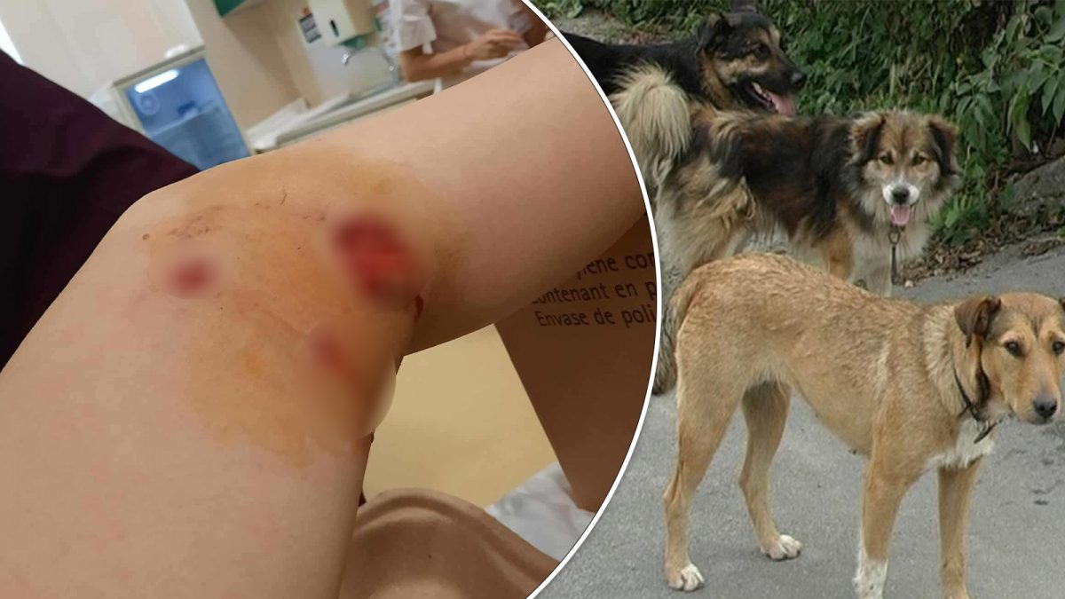 O copilă a fost mutilată de un câine maidanez, în Podu Iloaiei! Părinții se tem că incidentul s-ar putea repeta oricând: „E o teroare pentru toată lumea”