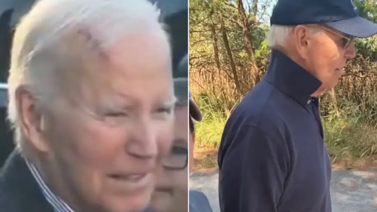 Joe Biden, filmat cu o cicatrice misterioasă pe frunte. Adevărul despre starea sa de sănătat