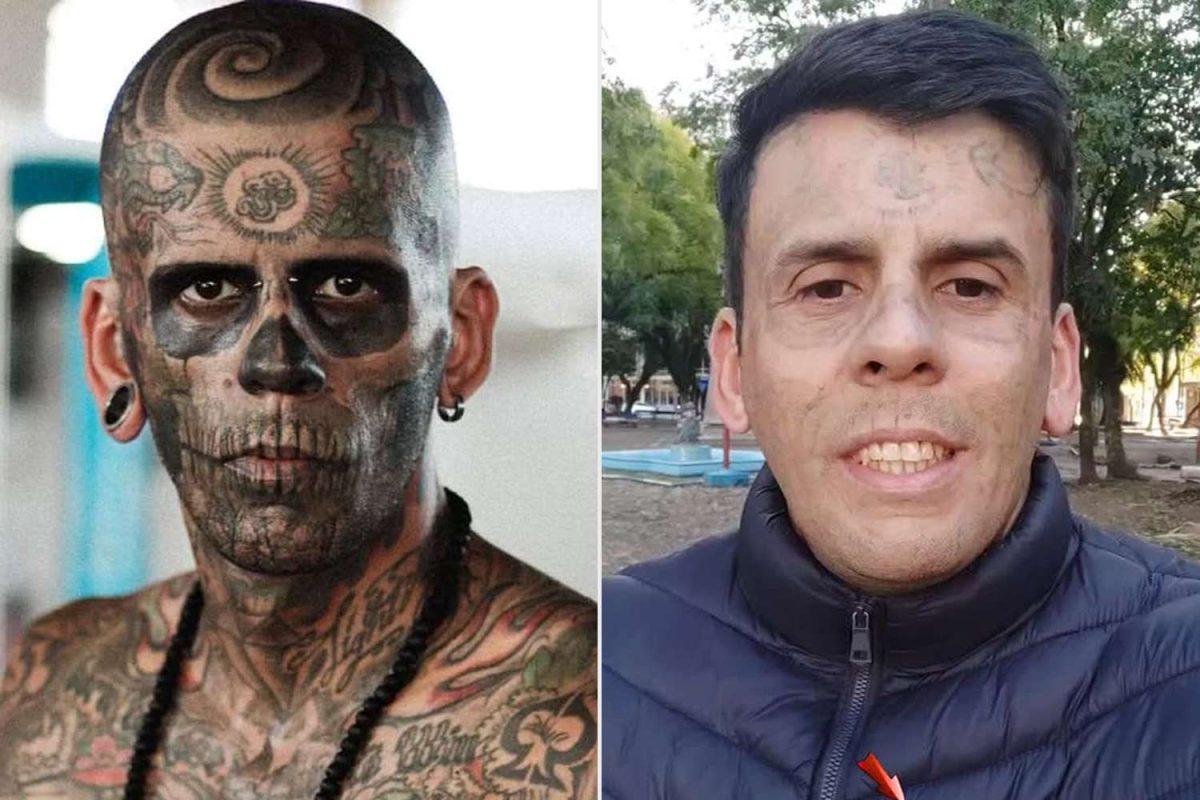 Omul cu 170 de tatuaje pe 95% din corp își șterge întreaga viață de pe piele. Durerea e infernală