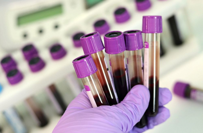Ce set de analize trebuie să faci pentru a depista boala celiacă? Iată cum se pune diagnosticul
