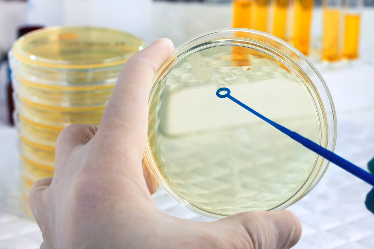 Care sunt valorile normale la urocultură și cum se interpretează rezultatele corect. Iată când o abatere indică o posibilă infecție urinară