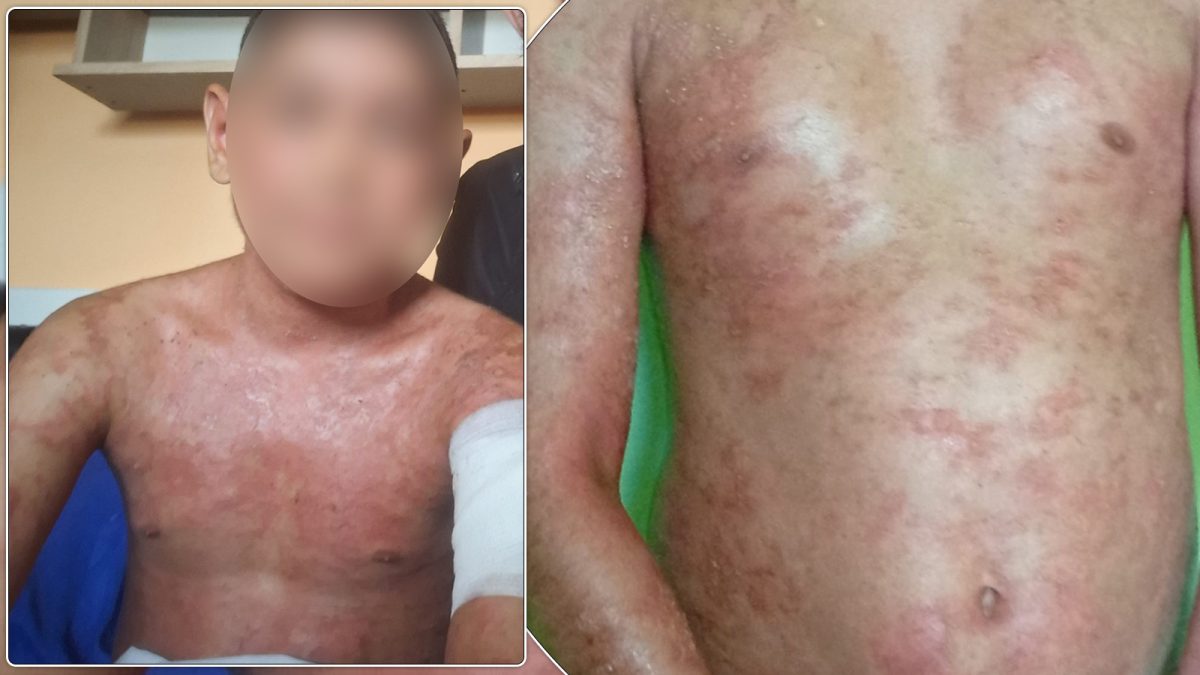 Apel disperat pentru Gabriel, un băiețel de 10 ani din Iași, care se luptă cu o boală cumplită. Familia cere ajutor pentru a-l salva: „Fiecare zi e o suferință pentru el”