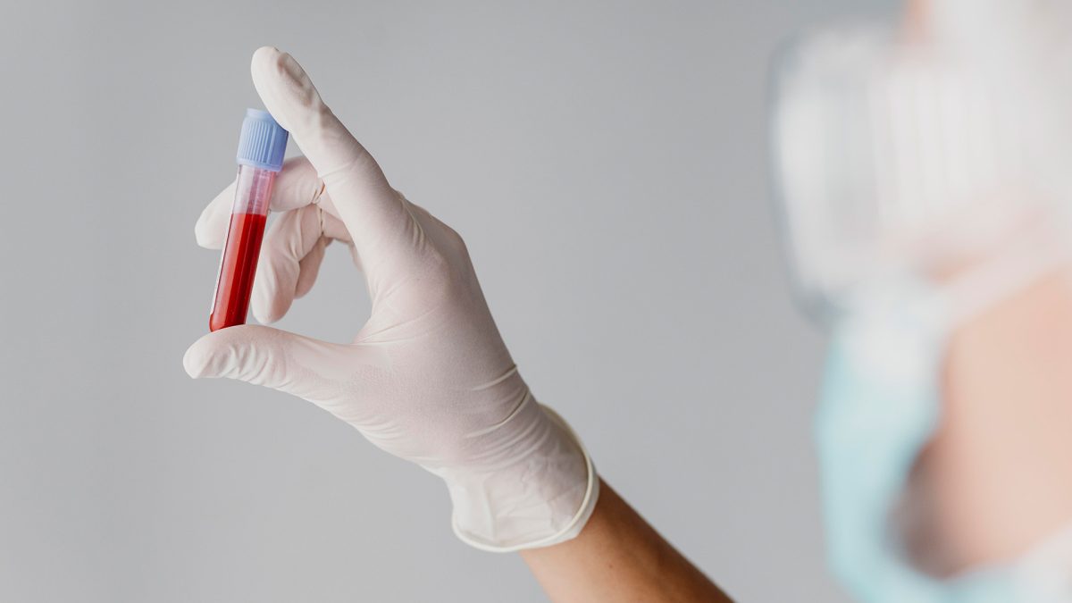 Ce analize de sânge pot detecta probleme hepatice