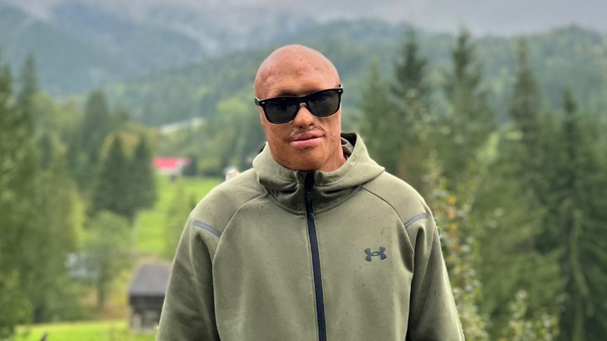 Gabriel Grigoriu, un tânăr mutilat din cauza unei explozii, vrea să arate că viața continuă și după o tragedie! Acesta vrea să devină antreprenor: „Și persoanele cu dizabilități pot să creeze locuri de muncă”