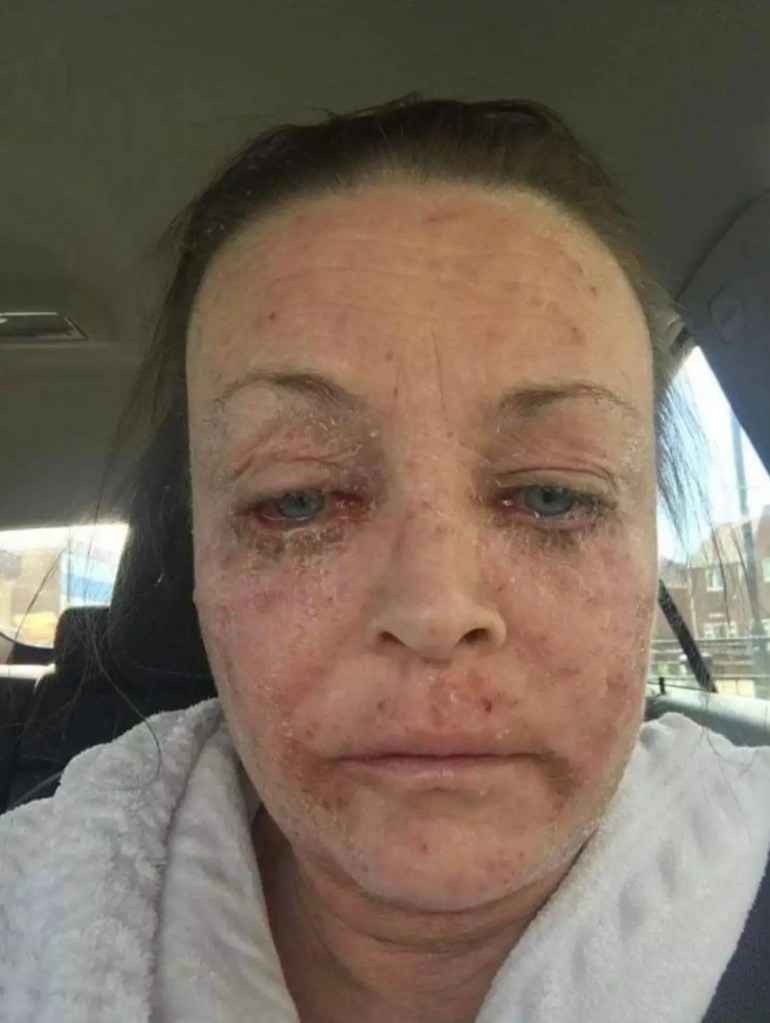 Dependența de alcool i-a distrus viața! Viciul a dus-o într-o stare critică pe o mamă de 46 de ani