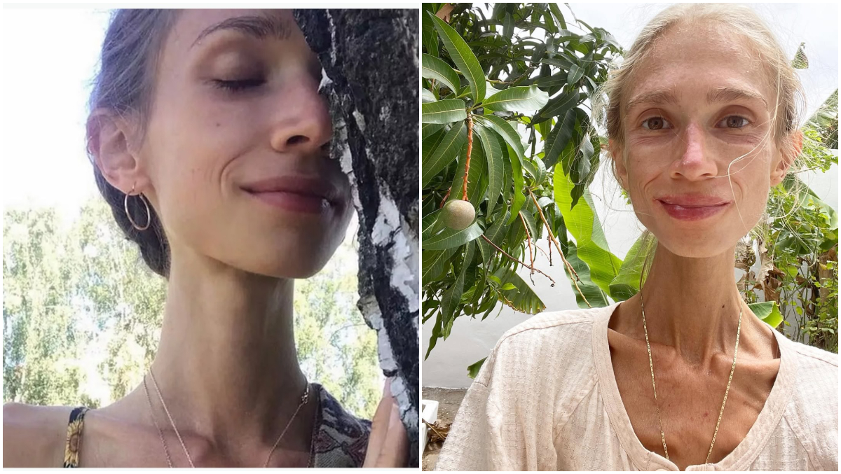 A vrut să slăbească, dar și-a pierdut viața! O tânără de 27 de ani a murit după o dietă cu fructe. Corpul ei ajunsese la doar 22 de kilograme!