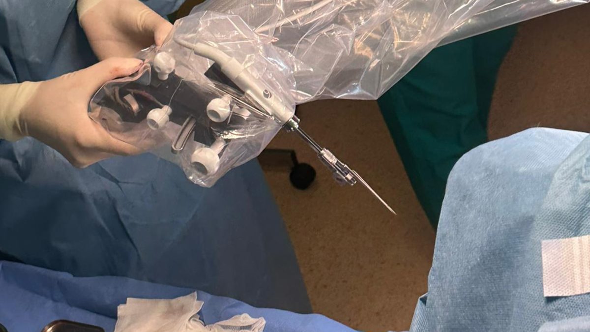 Premieră medicală la Iași! La Spitalul Clinic de Recuperare a fost realizată prima implantare cohleară asistată robotic în România