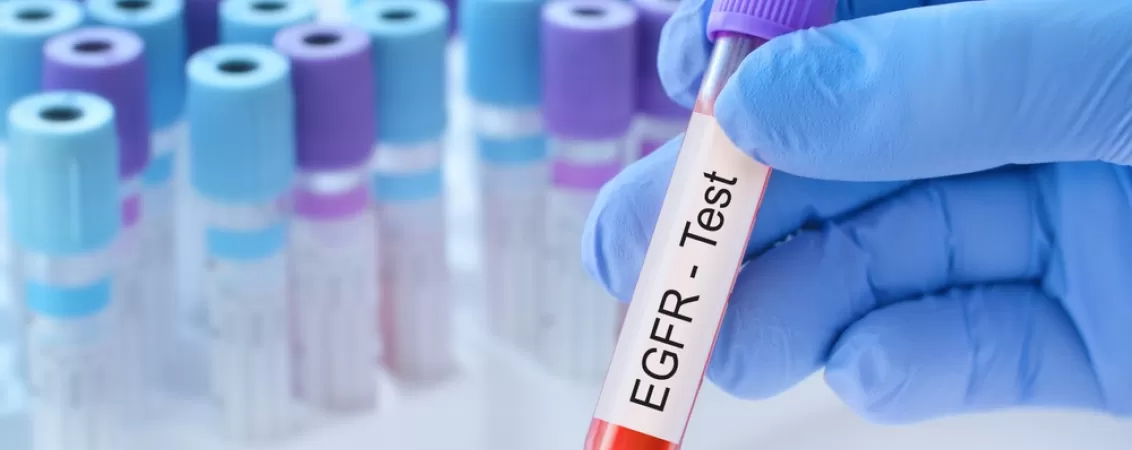 Ce înseamnă faptul că ai rata filtrării glomerurale scăzută? Iată ce opțiuni de tratament există