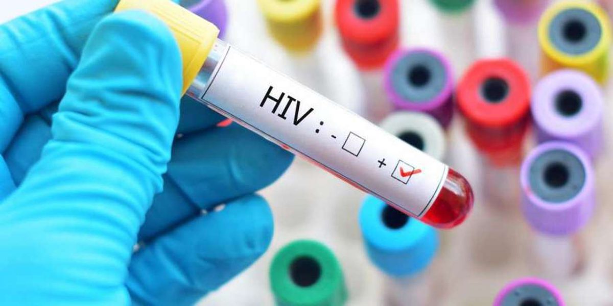 Cât trăiesc bolnavii de SIDA? Iată tot ce trebuie să știi despre speranța de viață a persoanelor infectate cu HIV