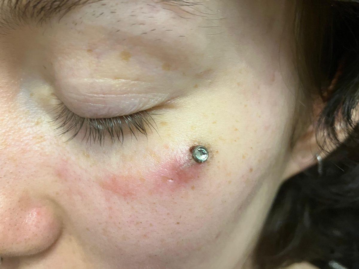 Cât de periculos poate fi un piercing dermal? Iată ce complicații pot apărea din cauza bijuteriilor montate sub piele!