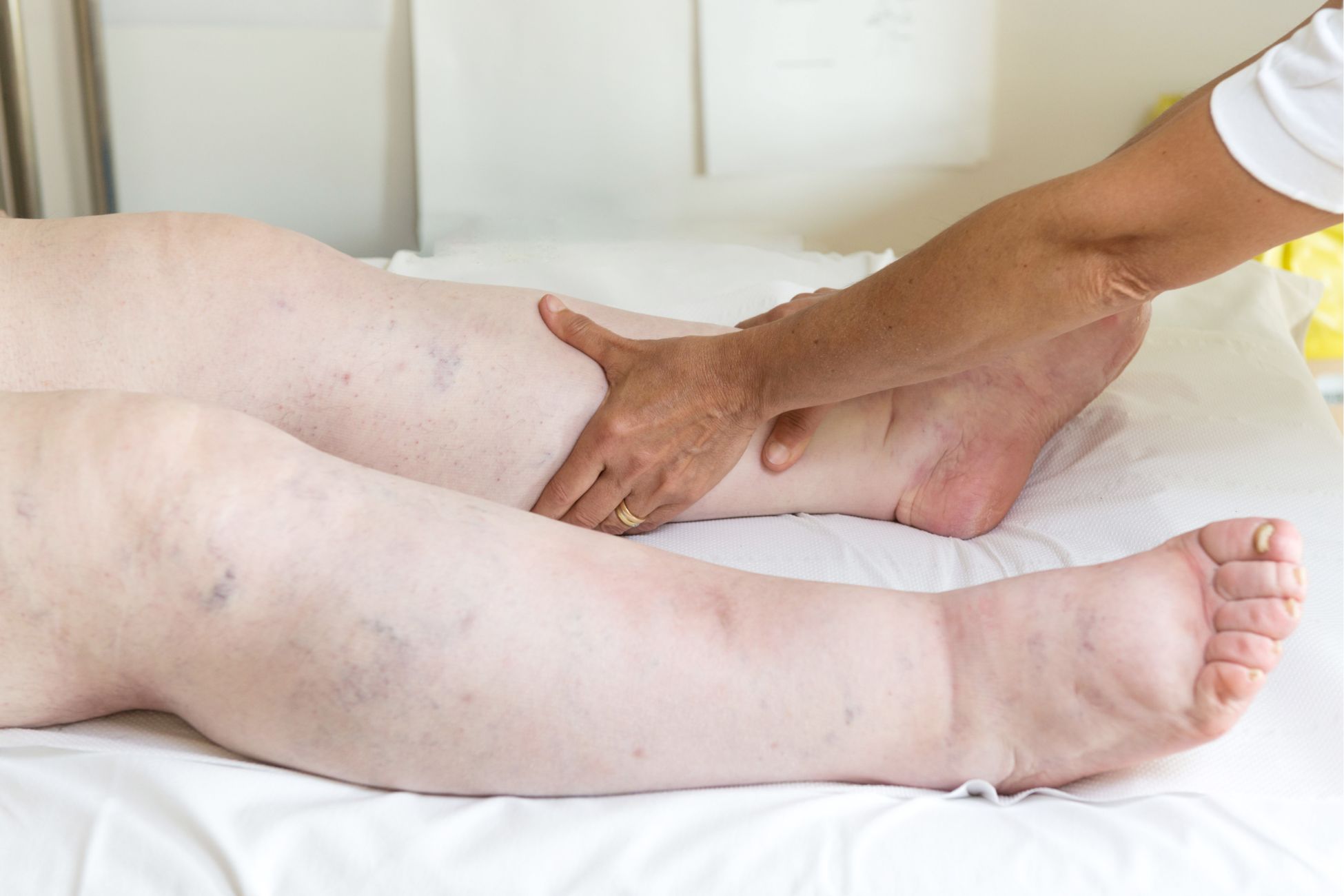din prostatită poate răni picioarele semnele aparitiei prostatei