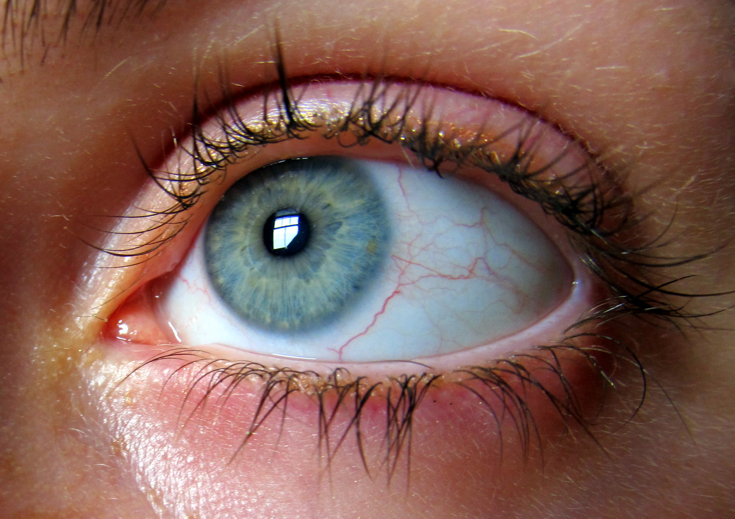 Cu vedere slabă, pupilele sunt dilatate