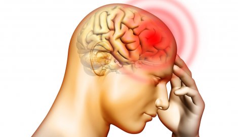 vindecarea migrenei