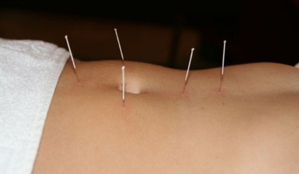 Tratamentul prostatitei cu puncte de acupunctură