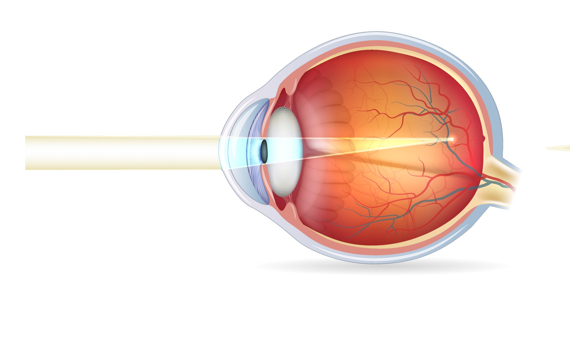 Cele mai multe boli oculare se moştenesc | instalatiigplconstanta.ro